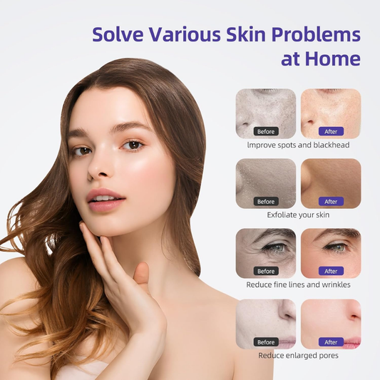 3-in-1 Diamond Microdermabrasion Facial Machine with Vacuum Spray
