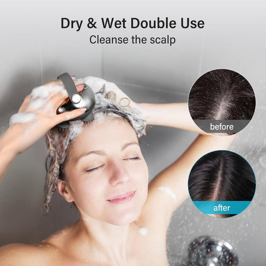 Electric Scalp Massager | Deep Cleansing & Relaxing Waterproof Head Massage Tool
