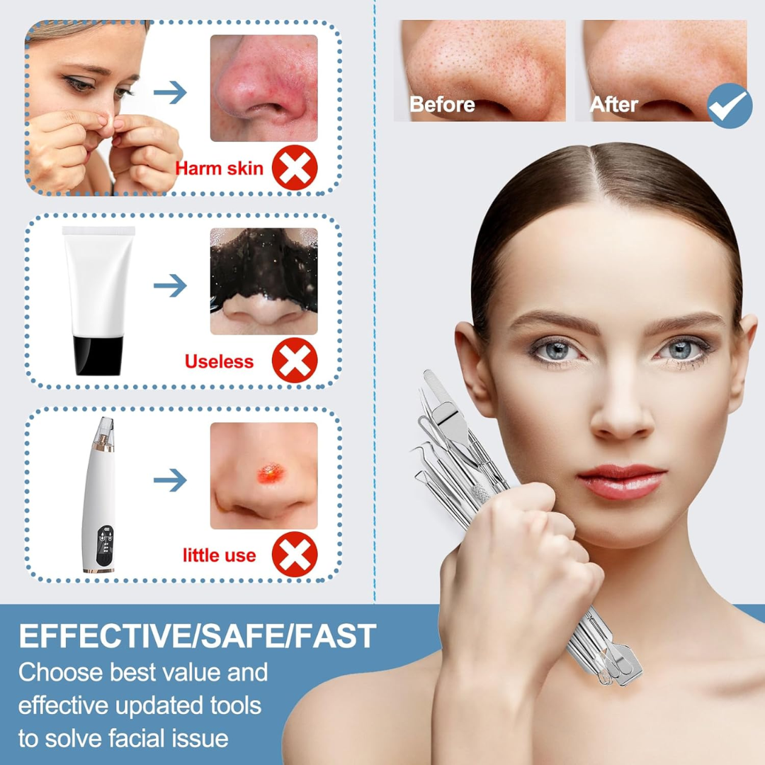 USB Rechargeable Blackhead Remover Vacuum with 3 Suction Levels & 6 Heads for Deep Pore Cleaning