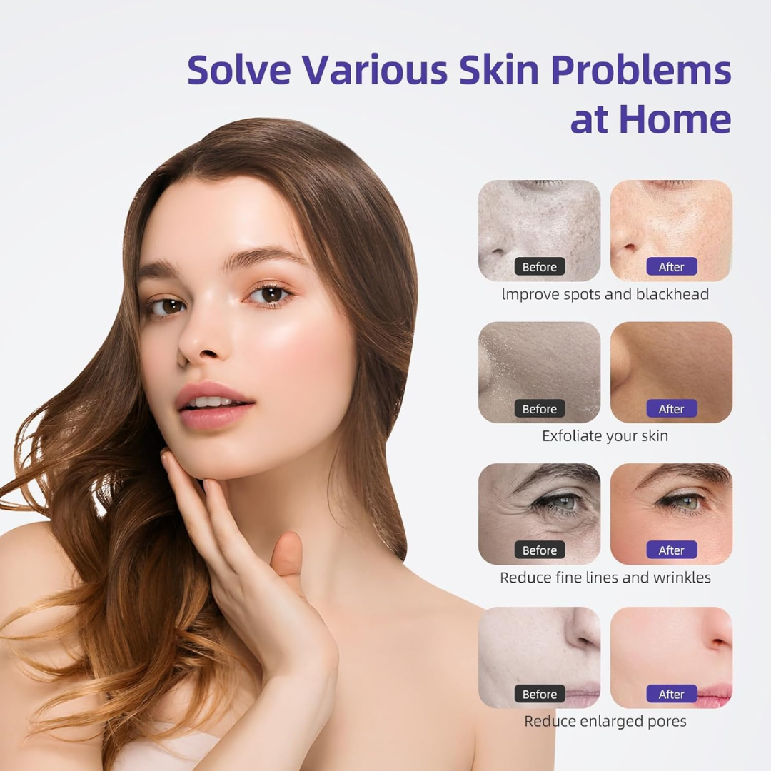3-in-1 Diamond Microdermabrasion Facial Machine with Vacuum Spray