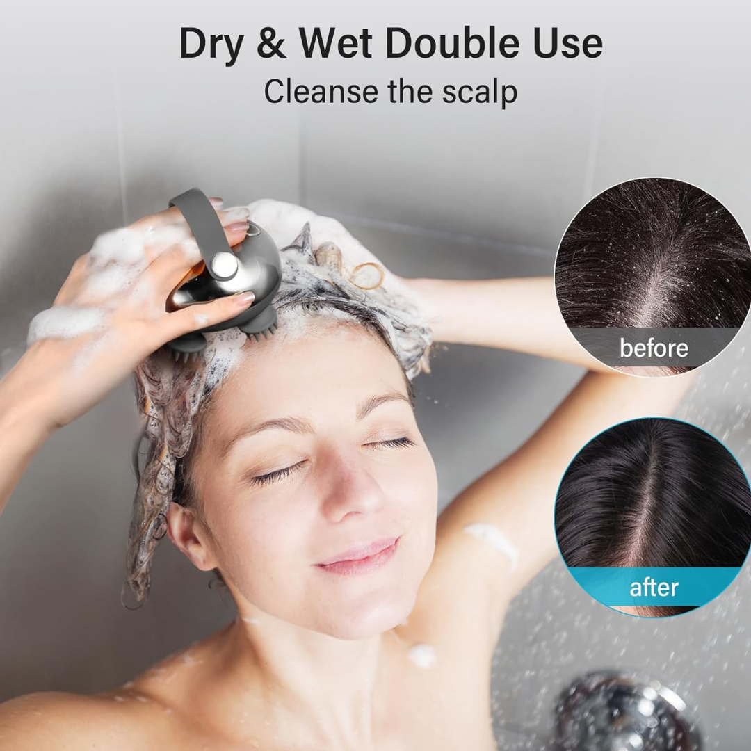 Arboleaf Scalp Massager – Electric Head Massager, IPX7 Waterproof, 8 Claws, 3 Modes, Portable Relaxation Device