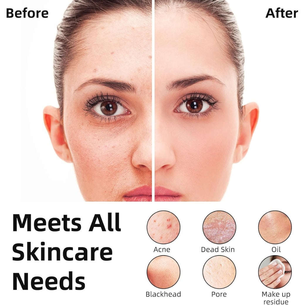 Facial Cleansing Brush Soft Exfoliating Face Wash Brush Pore Deep Cleansing Face Skincare Tool for Massaging Makeup Removal (Pink)